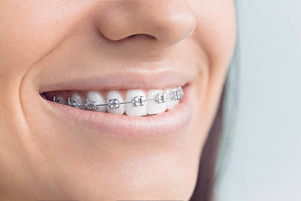 Best Invisalign and Clear Aligners  in Norris, TN